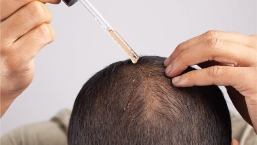 Queda de cabelo: causas, sintomas e como tratar de forma eficaz em 2025 3 Queda de cabelo tem prevenção